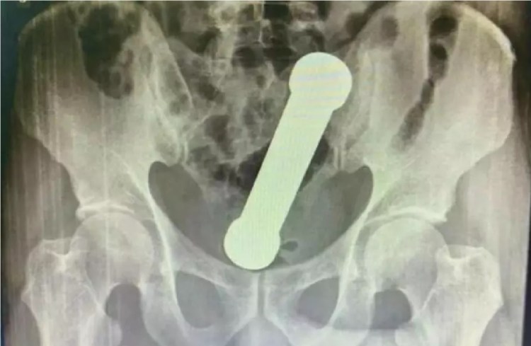 Acesse https://surgeaki.com e fique por dentro !